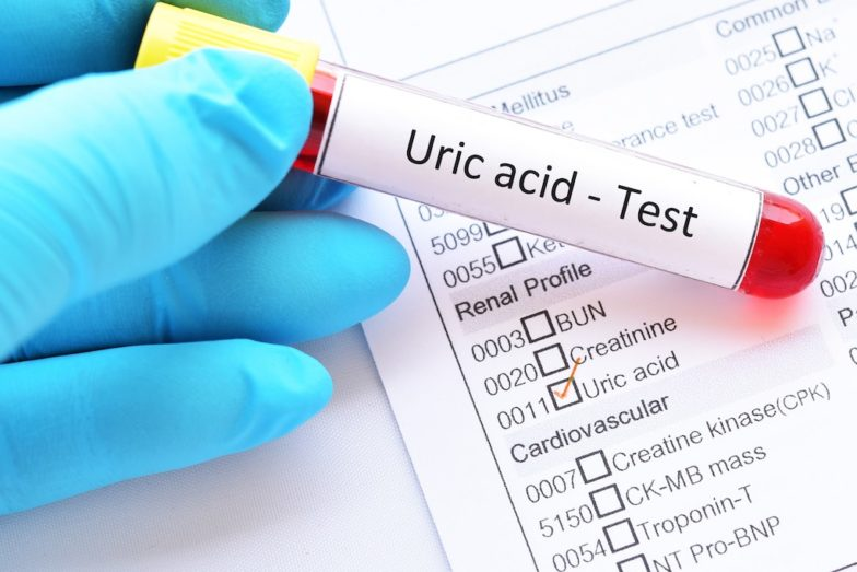 Acid uric cao có phải bị gút?