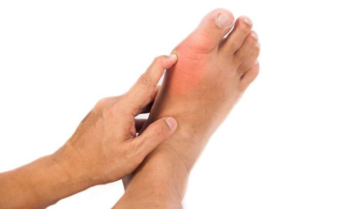 Đau ngón chân cái - một trong những dấu hiệu nhận biết bệnh gút