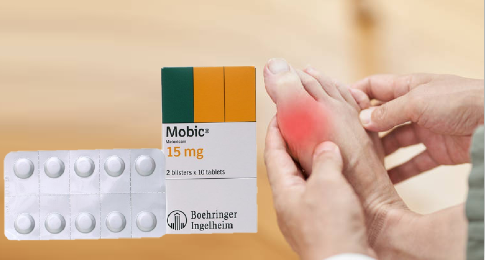 Có nên uống Mobic 7.5mg khi bị đau gút cấp không?