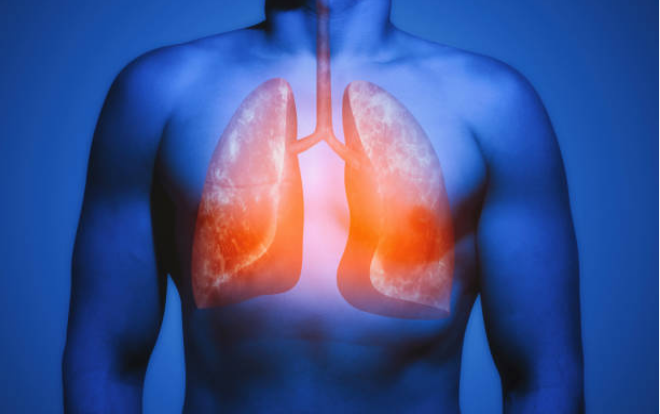 Nhiễm độc phổi là gì?