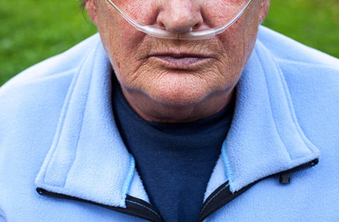 Người bệnh COPD giai đoạn 4 phải điều trị oxy dài hạn