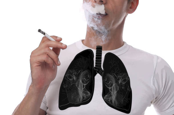 Người hút thuốc lá có nguy cơ cao mắc COPD