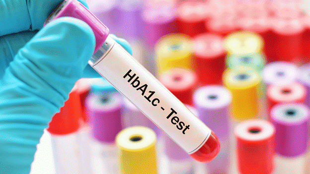 Test chỉ số HbA1C bằng máu
