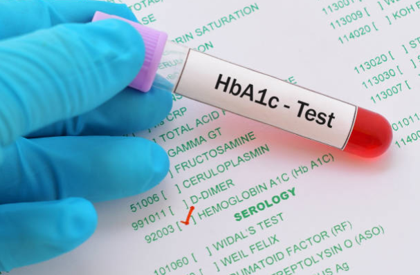 Chỉ số HbA1c rất quan trọng trong quá trình kiểm soát bệnh tiểu đường