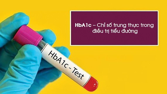 Bạn cần làm gì để kiểm soát chỉ số HbA1c với bệnh tiểu đường?