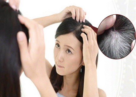 Nguyên nhân và giải pháp cải thiện tình trạng tóc bạc sớm ở nữ giới