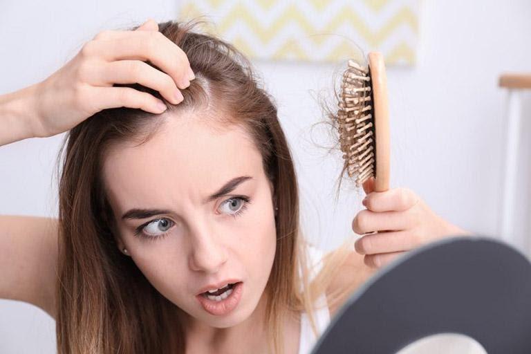 Tóc rụng có mọc lại được không? Giải pháp tối ưu dành cho người rụng tóc