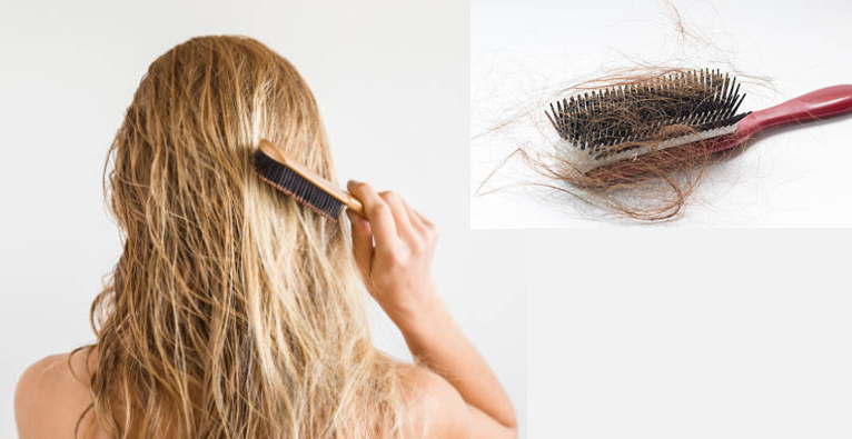 Top 7 nguyên nhân khiến tóc rụng nhiều khi gội đầu và giải pháp khắc phục hiệu quả