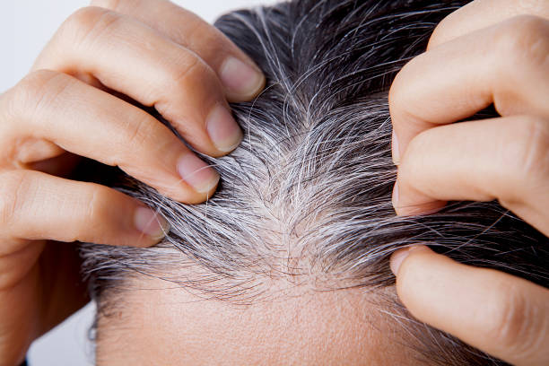 Cách khắc phục hiệu quả tóc bạc sớm ở người trẻ tuổi là gì?