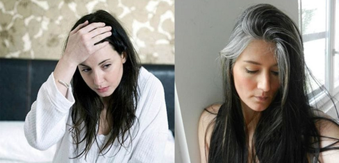 Chế độ ăn thiếu dinh dưỡng - Vừa gây tóc bạc sớm vừa không tốt cho sức khỏe