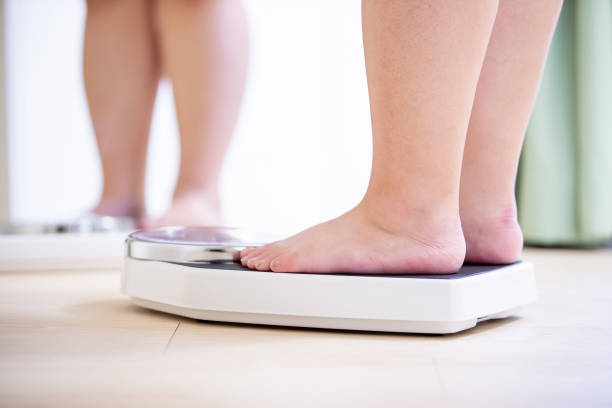  Kiểm soát cân nặng giúp phòng ngừa suy giãn tĩnh mạch
