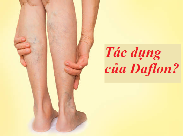Những thông tin cần biết về Daflon trong điều trị suy giãn tĩnh mạch chân