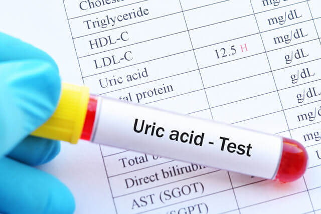 Mối liên quan giữa nồng độ acid uric và nguy cơ mắc bệnh cao huyết áp