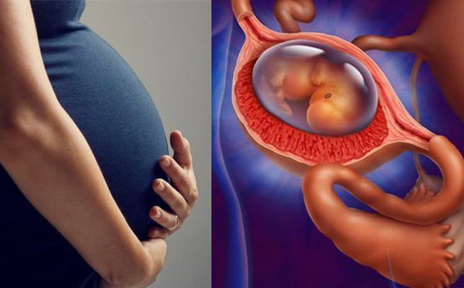 Chửa ngoài tử cung là gì ? Nguyên nhân và dấu hiệu nhận biết