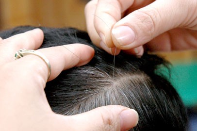 Những cách đơn giản chữa tóc bạc sớm